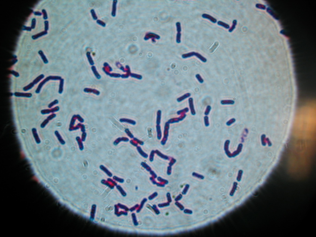 Bacillus cereus 10000 mag BCCDC Labs.jpg